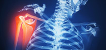BONE AND JOINT DISORDERS